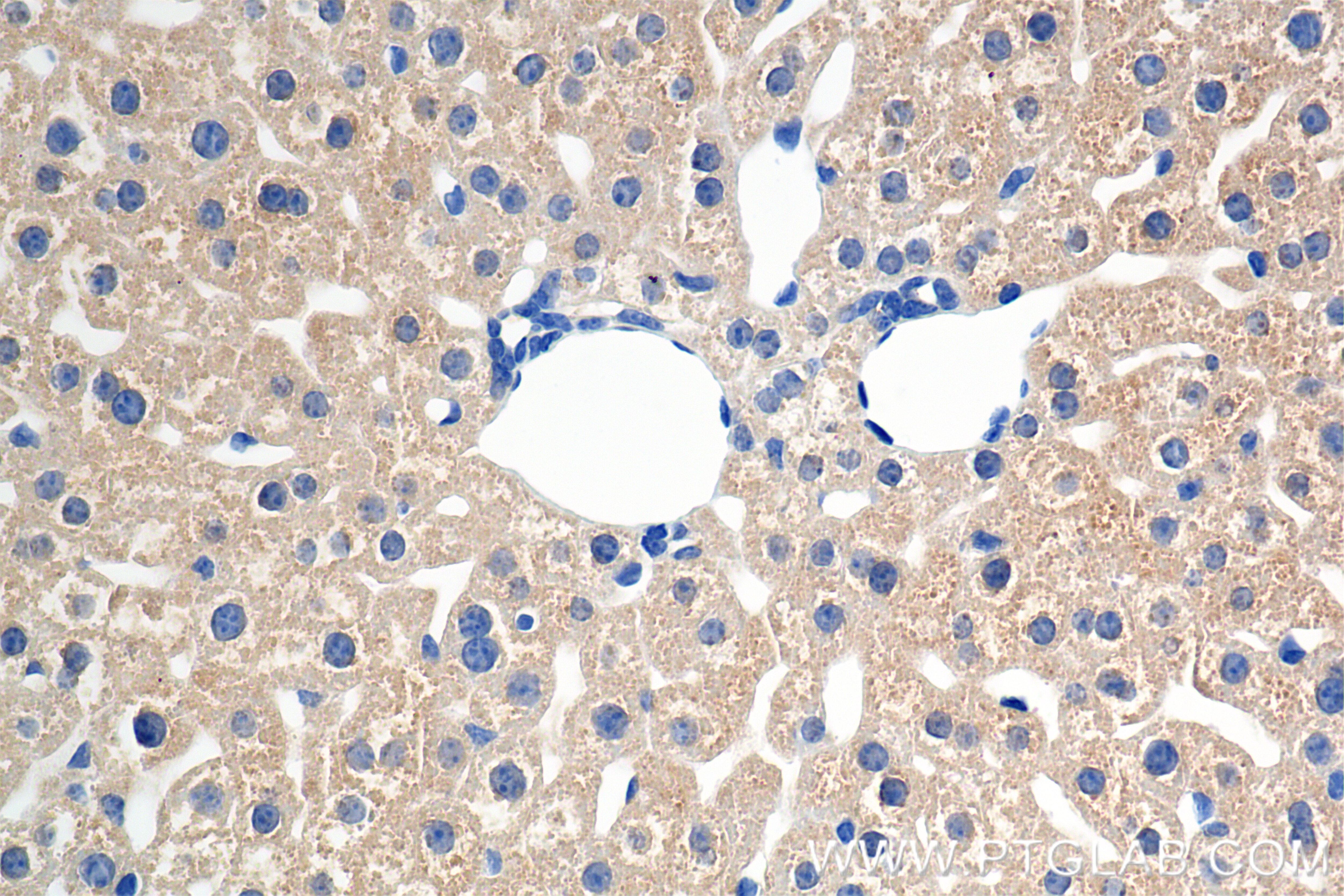 Immunohistochemistry (IHC) staining of mouse liver tissue using DcR2 Recombinant antibody (85425-2-RR)