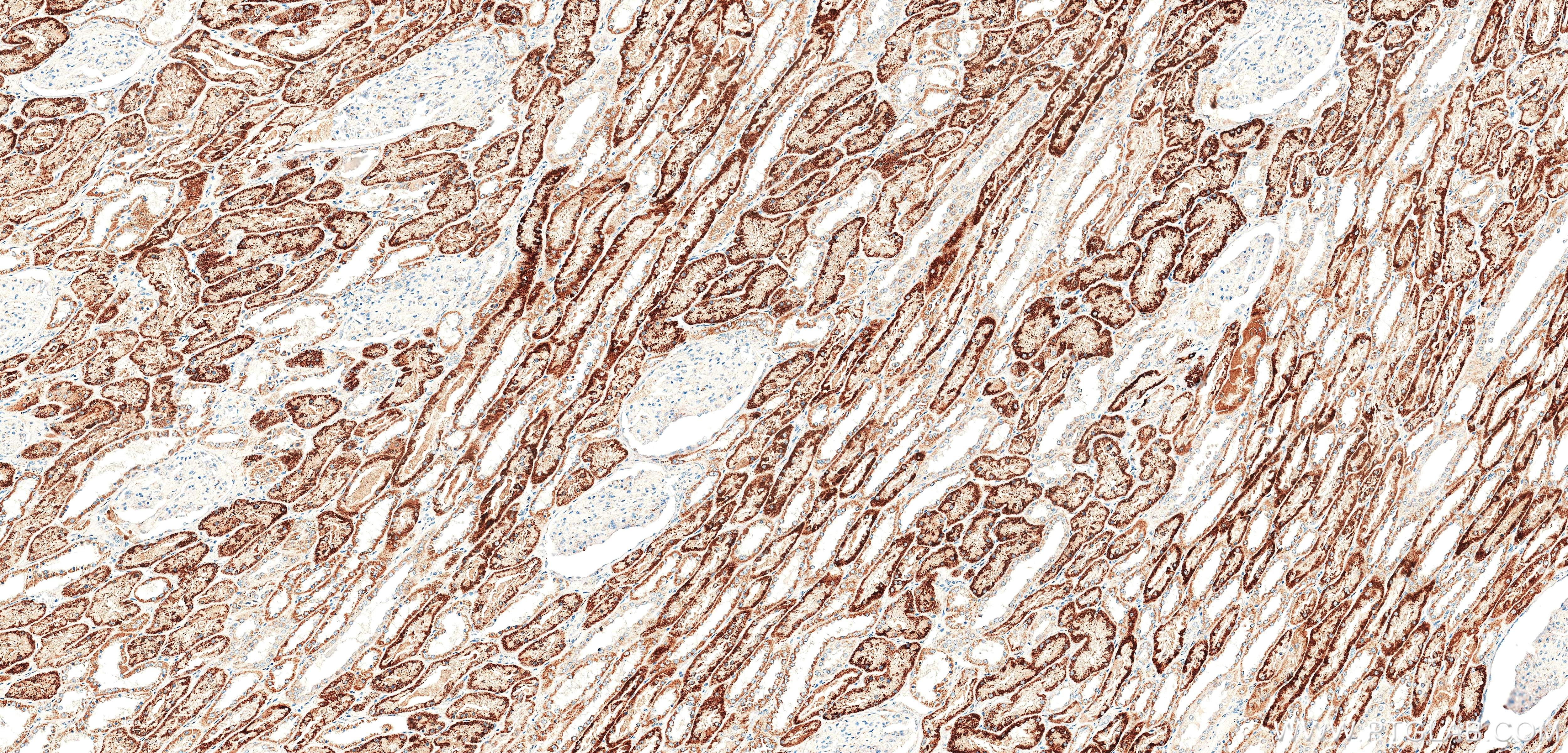 Immunohistochemistry (IHC) staining of human kidney tissue using DcR2 Recombinant monoclonal antibody (85425-2-RR)