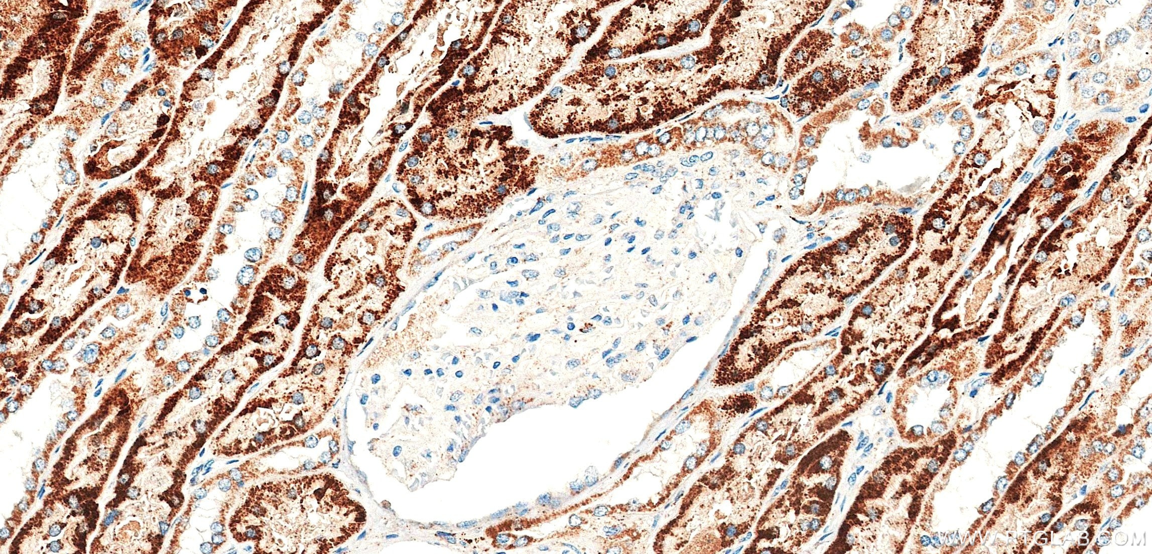 Immunohistochemistry (IHC) staining of human kidney tissue using DcR2 Recombinant monoclonal antibody (85425-2-RR)