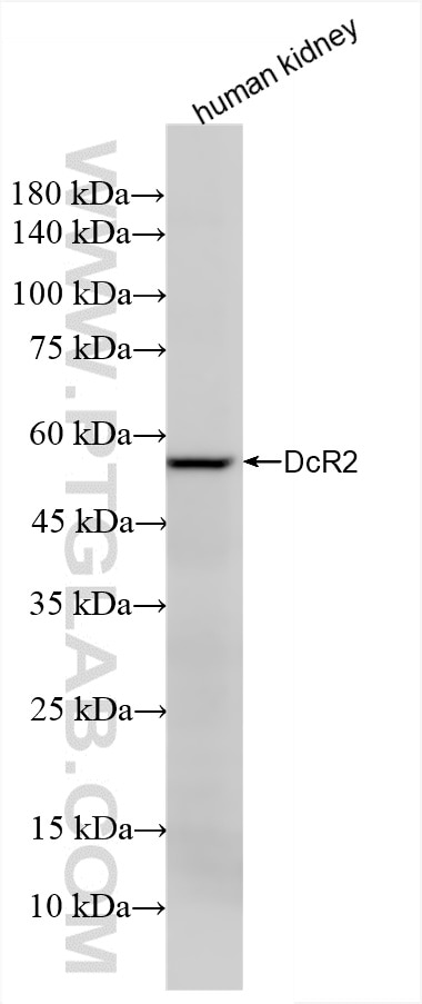 Western Blot (WB) analysis of various lysates using DcR2 Recombinant antibody (85425-2-RR)