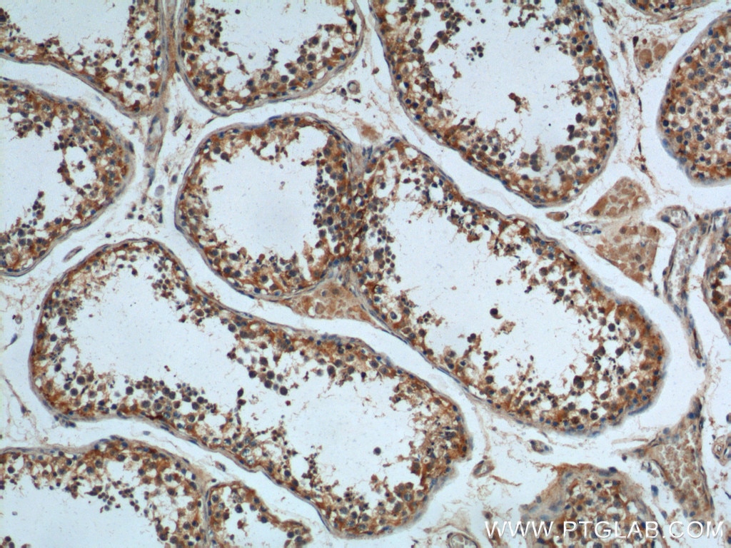 Immunohistochemistry (IHC) staining of human testis tissue using TRAIP Polyclonal antibody (10332-1-AP)