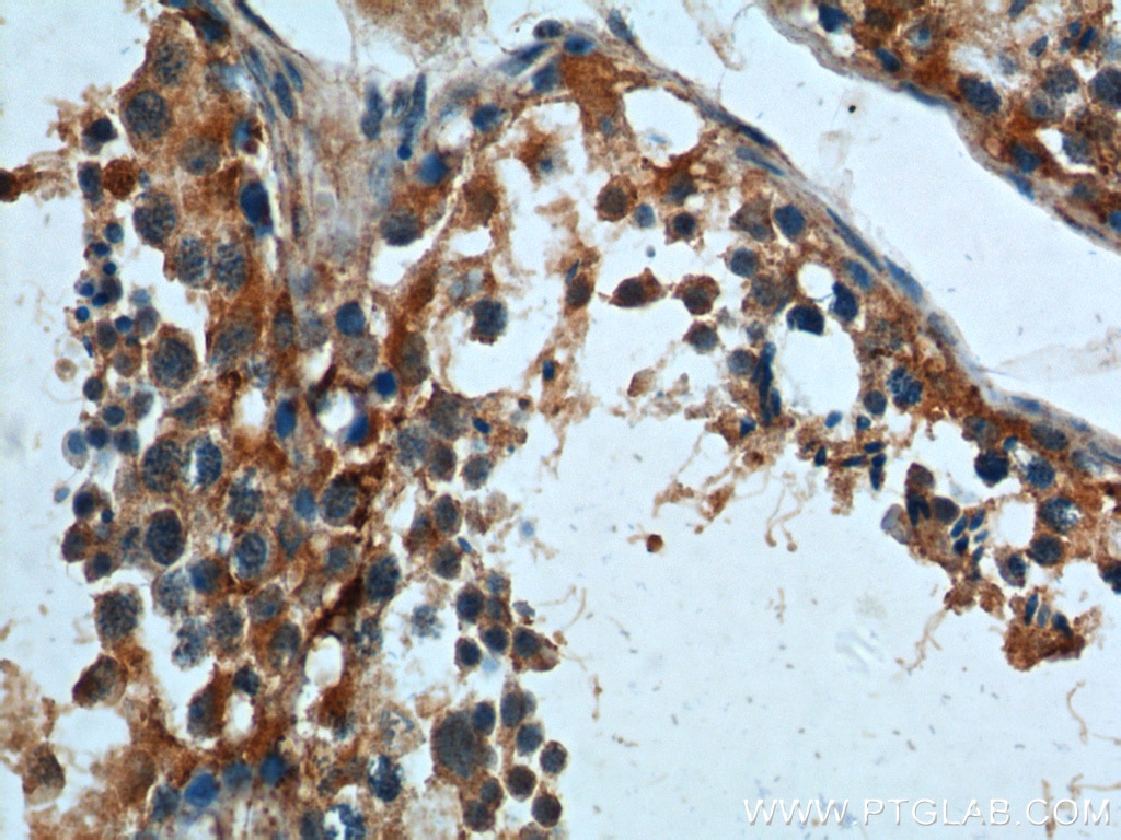 Immunohistochemistry (IHC) staining of human testis tissue using TRAIP Polyclonal antibody (10332-1-AP)