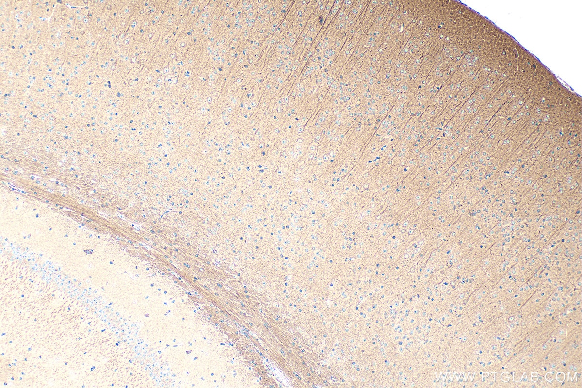 Immunohistochemistry (IHC) staining of mouse brain tissue using TRAIP Polyclonal antibody (10332-1-AP) Immunohistochemistry (IHC) staining of mouse brain tissue using TRAIP Polyclonal antibody (10332-1-AP)