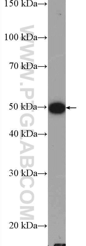 Western Blot (WB) analysis of A549 cells using TRAIP Polyclonal antibody (10332-1-AP)