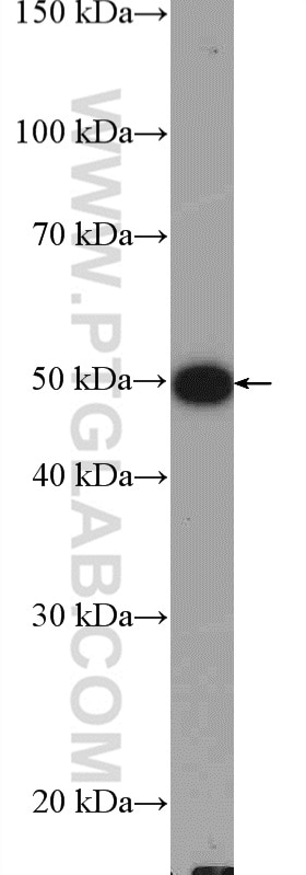 WB analysis of A549 using 10332-1-AP