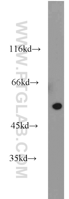 Western Blot (WB) analysis of mouse brain tissue using TRAIP Polyclonal antibody (10332-1-AP)