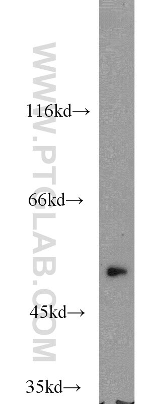 Western Blot (WB) analysis of mouse placenta tissue using TRAIP Polyclonal antibody (10332-1-AP)