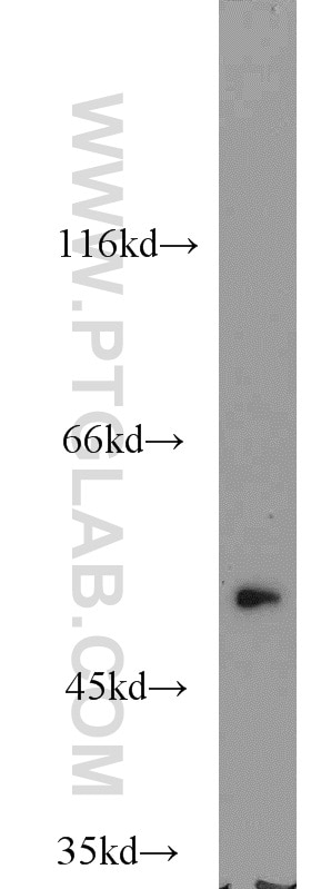 WB analysis of mouse placenta using 10332-1-AP