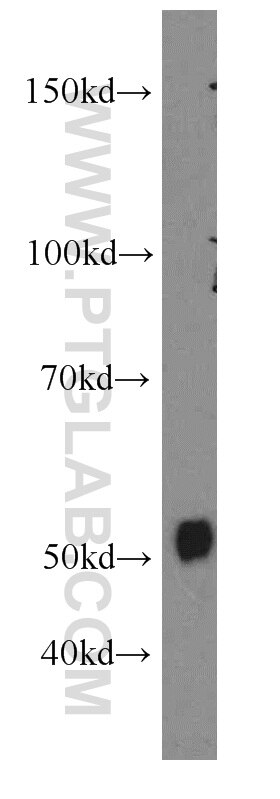 Western Blot (WB) analysis of human brain tissue using TRAIP Polyclonal antibody (10332-1-AP)