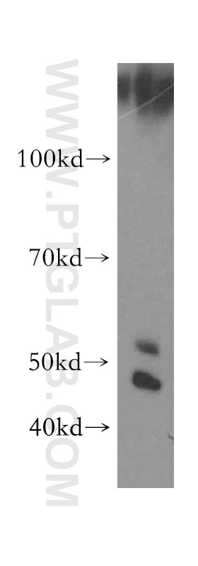 Western Blot (WB) analysis of human placenta tissue using TRAIP Polyclonal antibody (10332-1-AP)