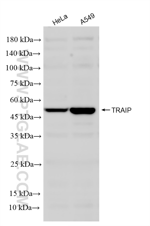 Western Blot (WB) analysis of various lysates using TRAIP Recombinant monoclonal antibody (86808-1-RR)