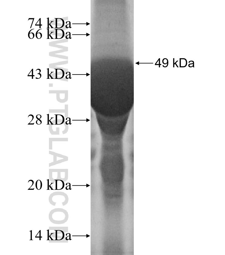 TRAIP fusion protein Ag0491 SDS-PAGE