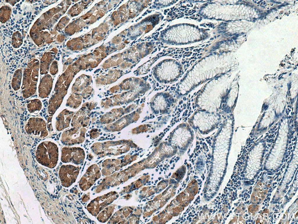 Immunohistochemistry (IHC) staining of human stomach tissue using TRAK1 Polyclonal antibody (13987-1-AP)