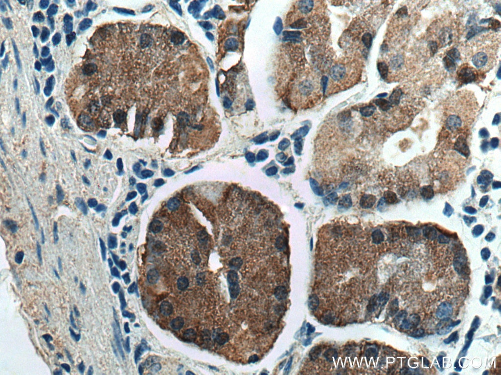 Immunohistochemistry (IHC) staining of human stomach tissue using TRAK1 Polyclonal antibody (13987-1-AP)
