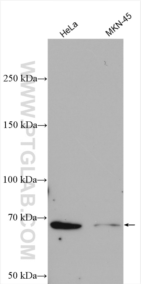 Western Blot (WB) analysis of various lysates using TRAK1 Polyclonal antibody (13987-1-AP)