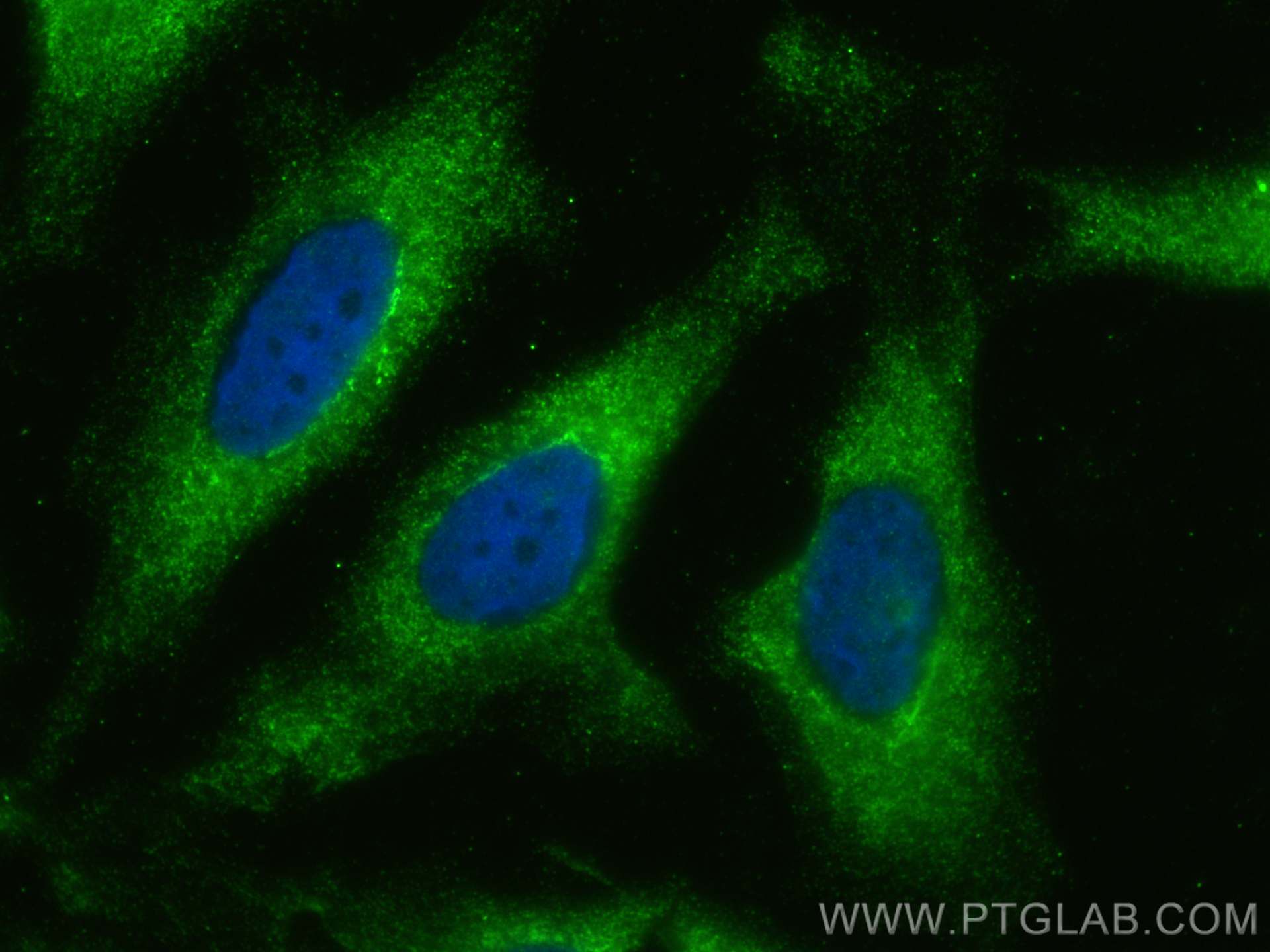 Immunofluorescence (IF) / fluorescent staining of HeLa cells using TRAK2 Polyclonal antibody (13770-1-AP)