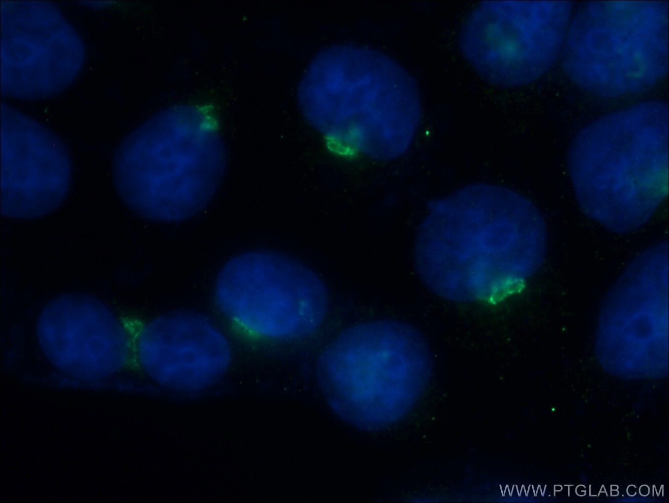 Immunofluorescence (IF) / fluorescent staining of HeLa cells using TRAK2 Polyclonal antibody (13770-1-AP)