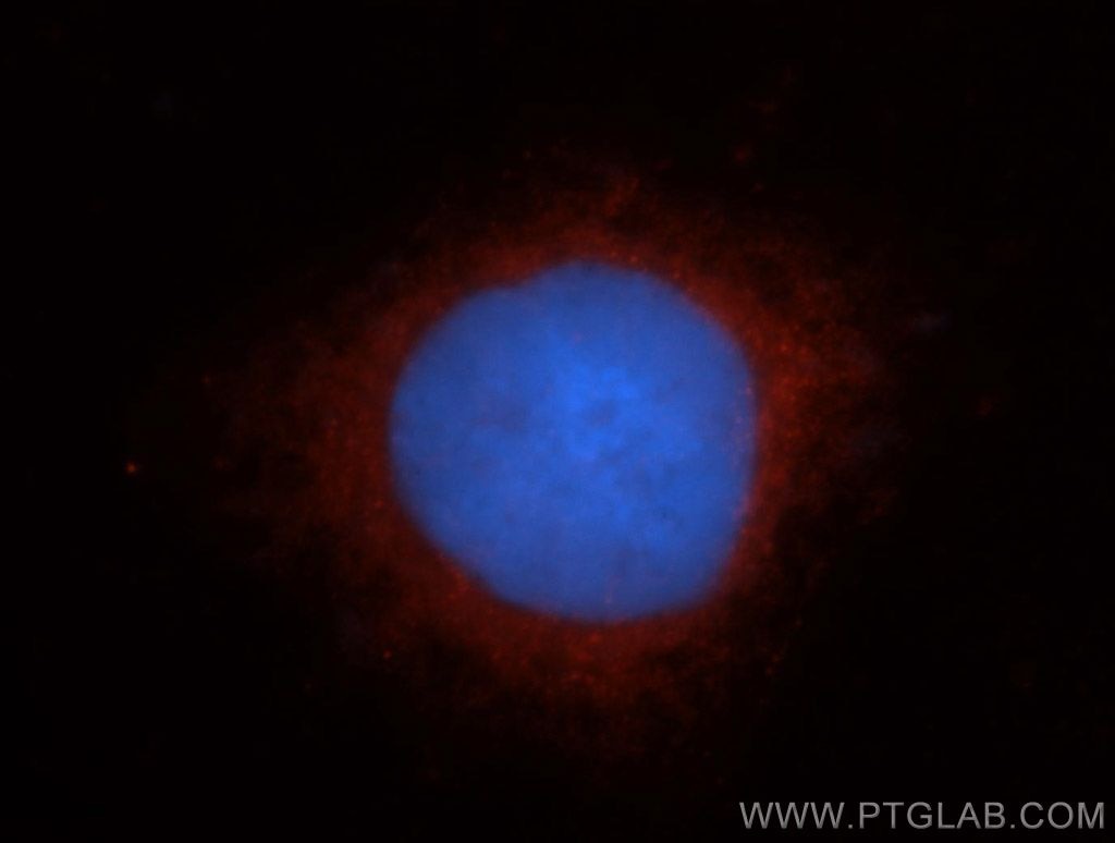 Immunofluorescence (IF) / fluorescent staining of HeLa cells using TRAK2 Polyclonal antibody (13770-1-AP)