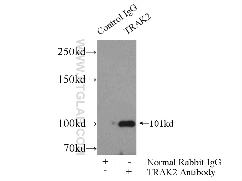 Immunoprecipitation (IP) experiment of HepG2 cells using TRAK2 Polyclonal antibody (13770-1-AP)