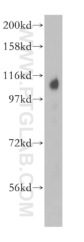 Western Blot (WB) analysis of human liver tissue using TRAK2 Polyclonal antibody (13770-1-AP)