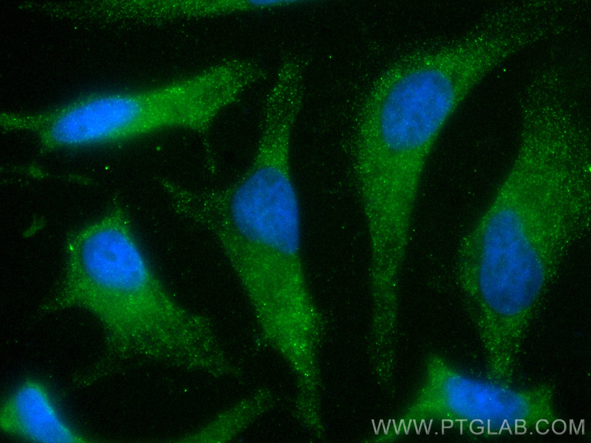 Immunofluorescence (IF) / fluorescent staining of HeLa cells using CoraLite® Plus 488-conjugated TRAK2 Polyclonal ant (CL488-13770)