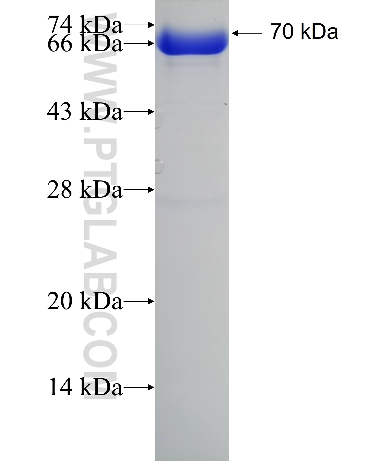 TRAK2 fusion protein Ag4753 SDS-PAGE