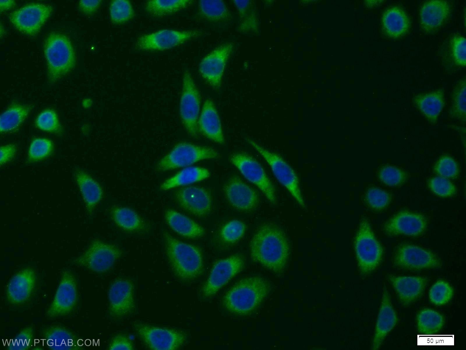 Immunofluorescence (IF) / fluorescent staining of PC-3 cells using TRAM1 Polyclonal antibody (12705-1-AP)
