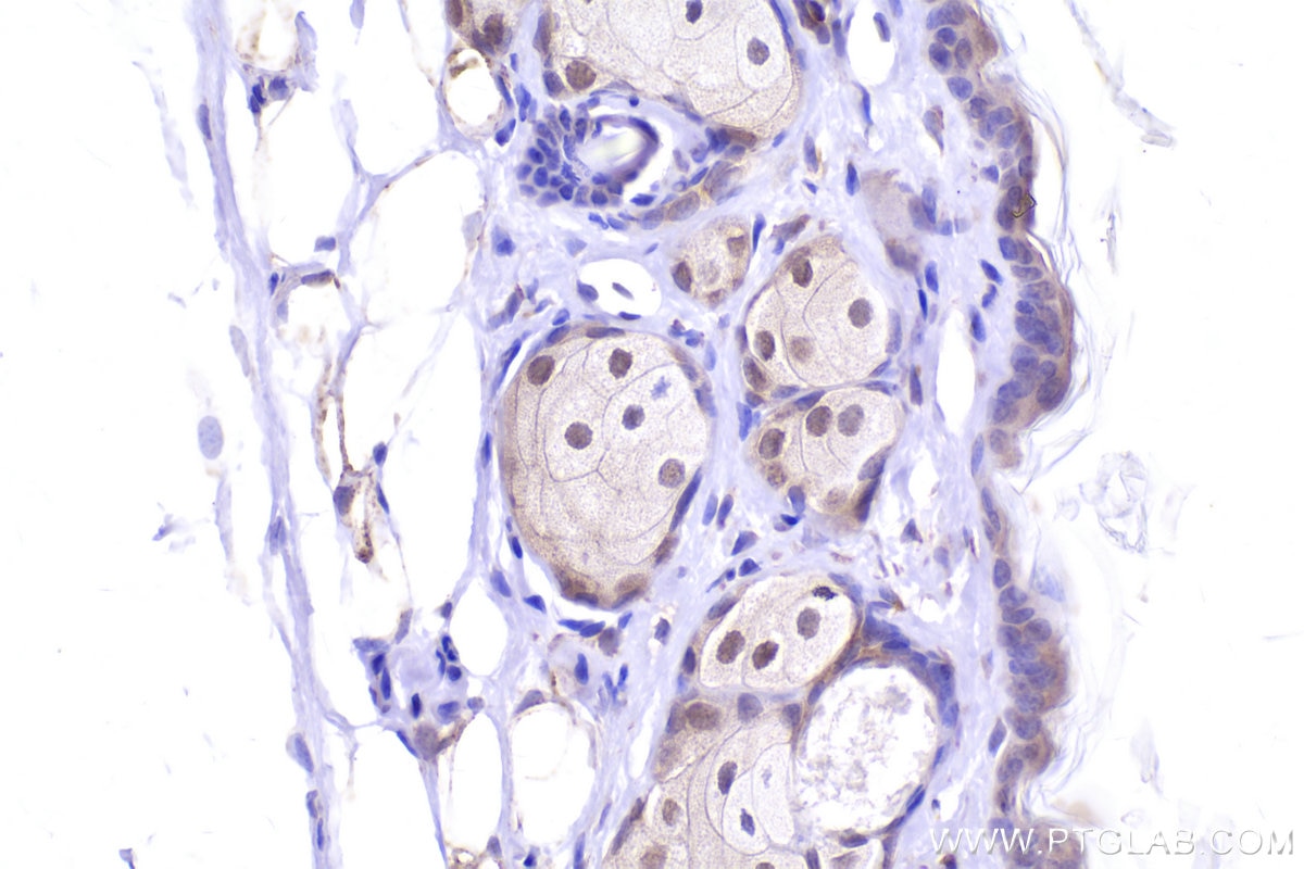 Immunohistochemistry (IHC) staining of mouse skin tissue using TRAM1 Polyclonal antibody (12705-1-AP)