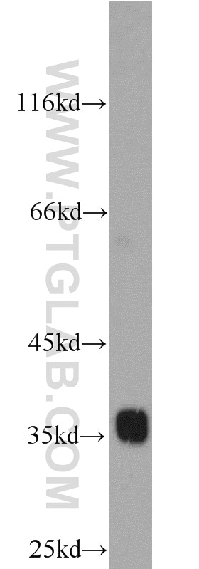 Western Blot (WB) analysis of HeLa cells using TRAM1 Polyclonal antibody (12705-1-AP)