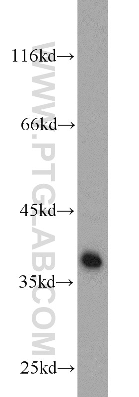 Western Blot (WB) analysis of PC-3 cells using TRAM1 Polyclonal antibody (12705-1-AP)