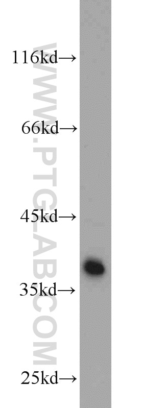 WB analysis of PC-3 using 12705-1-AP