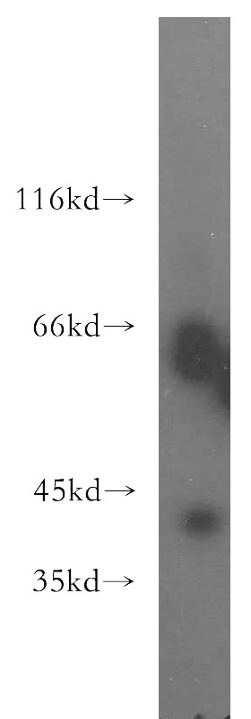 Western Blot (WB) analysis of HepG2 cells using TRAM2 Polyclonal antibody (13311-1-AP)