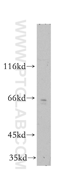 Western Blot (WB) analysis of Sp2/0 cells using TRAM2 Polyclonal antibody (13311-1-AP)