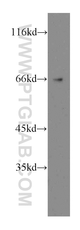 Western Blot (WB) analysis of HepG2 cells using TRAM2 Polyclonal antibody (13311-1-AP)