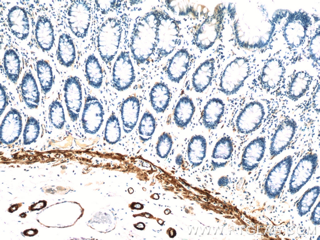 Immunohistochemistry (IHC) staining of human colon tissue using transgelin/SM22-specific Polyclonal antibody (15502-1-AP)