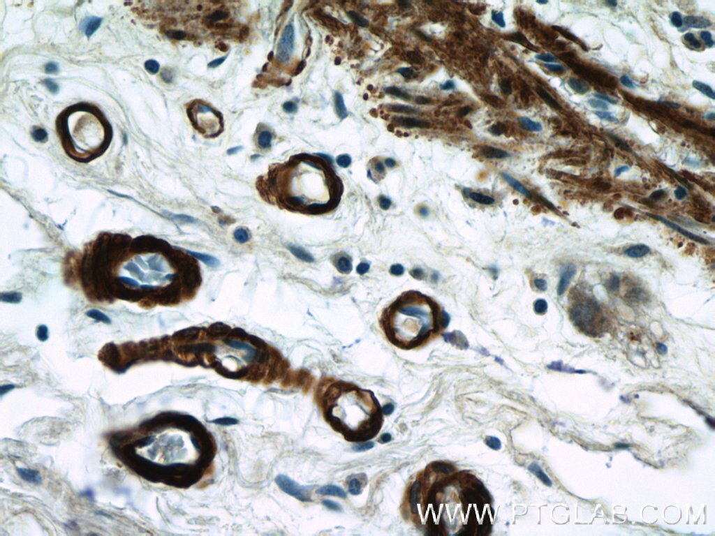 IHC staining of human colon using 15502-1-AP