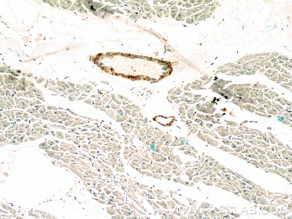 Immunohistochemistry (IHC) staining of human heart tissue using transgelin/SM22-specific Polyclonal antibody (15502-1-AP)