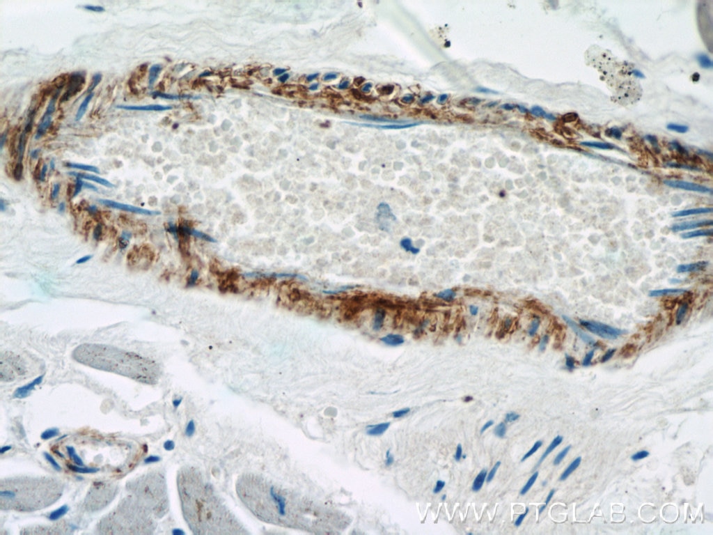 Immunohistochemistry (IHC) staining of human heart tissue using transgelin/SM22-specific Polyclonal antibody (15502-1-AP)