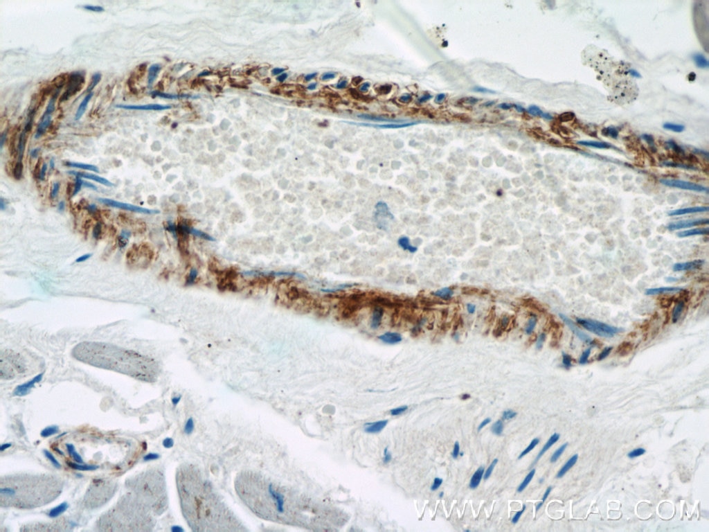 IHC staining of human heart using 15502-1-AP