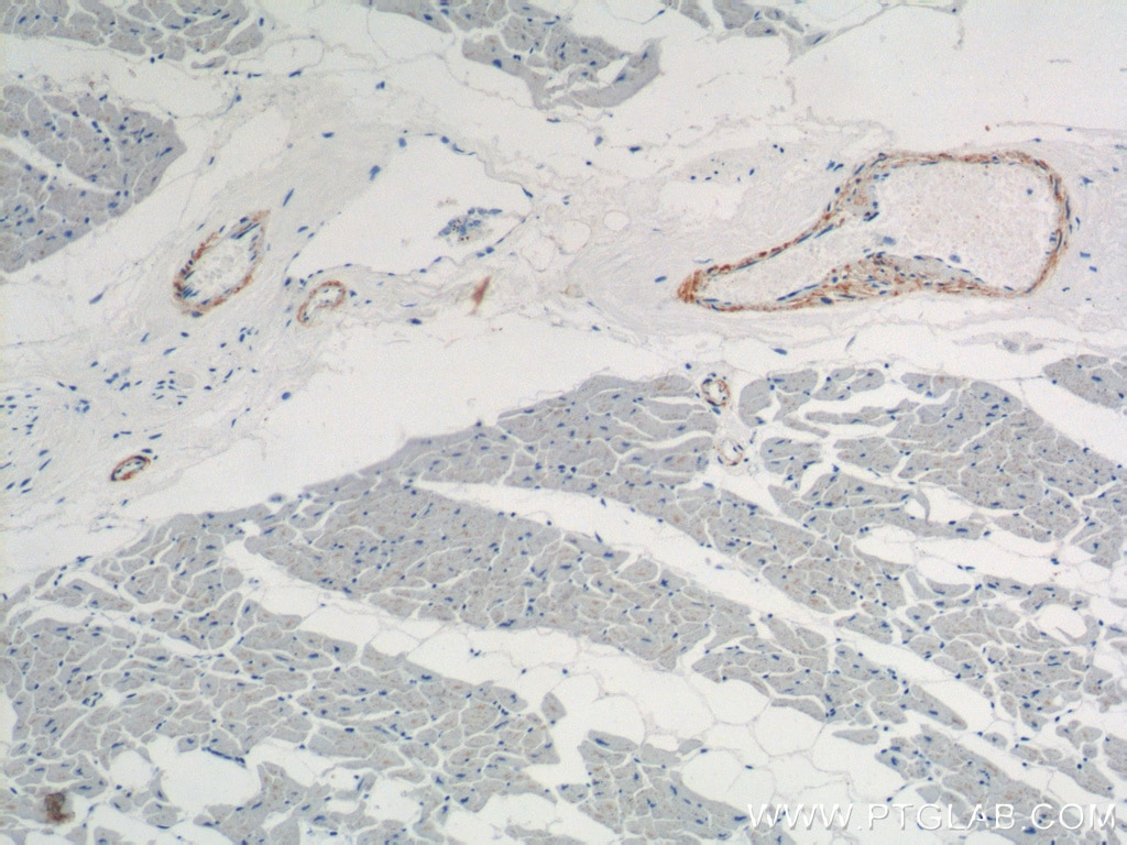 IHC staining of human heart using 15502-1-AP