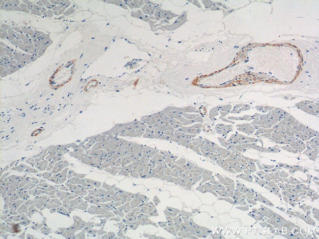 Immunohistochemistry (IHC) staining of human heart tissue using transgelin/SM22-specific Polyclonal antibody (15502-1-AP)