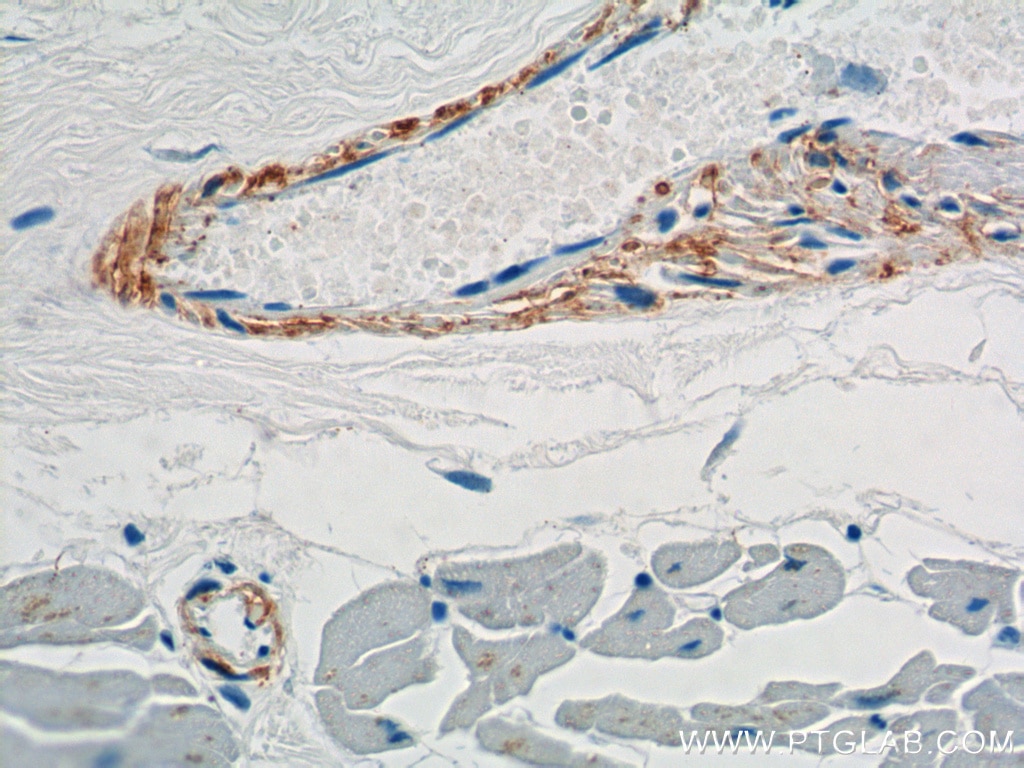 Immunohistochemistry (IHC) staining of human heart tissue using transgelin/SM22-specific Polyclonal antibody (15502-1-AP)
