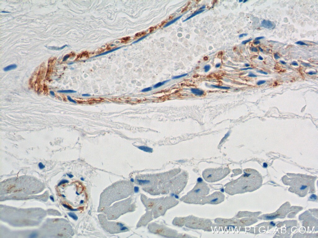 IHC staining of human heart using 15502-1-AP