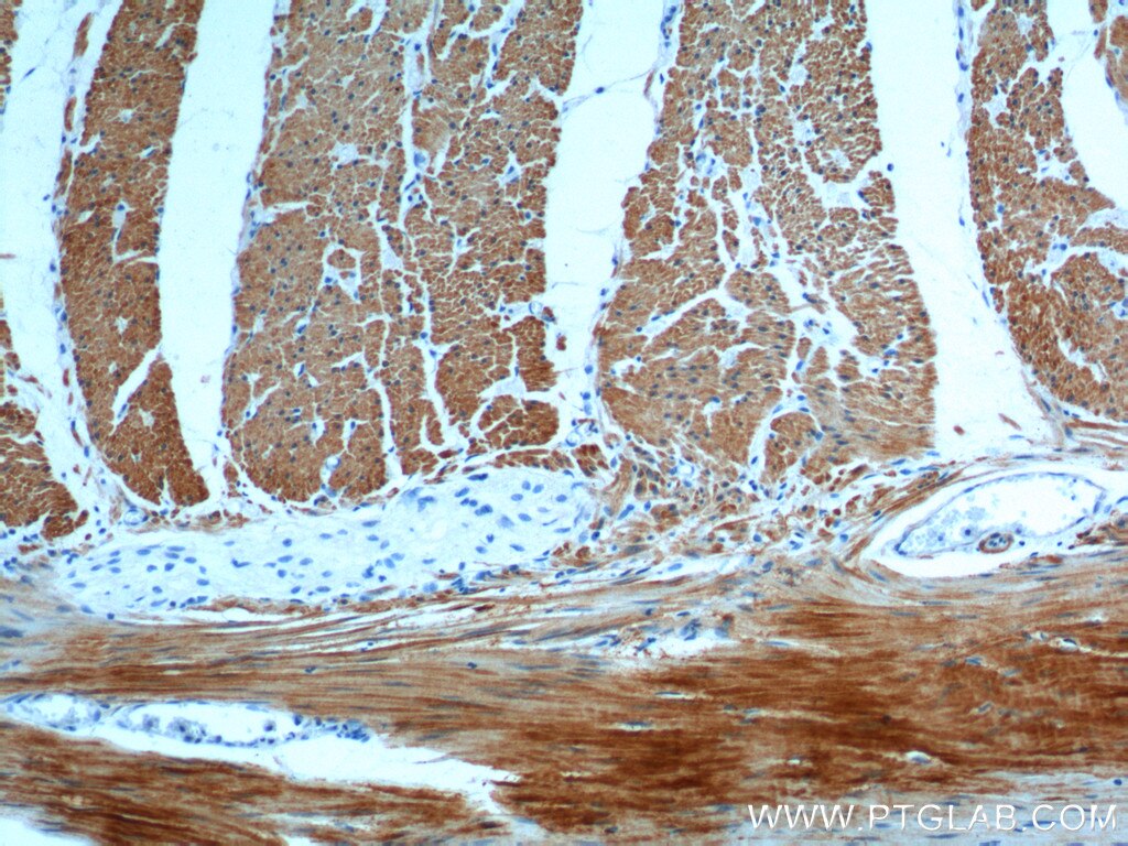 Immunohistochemistry (IHC) staining of human colon tissue using transgelin/SM22-specific Polyclonal antibody (15502-1-AP)