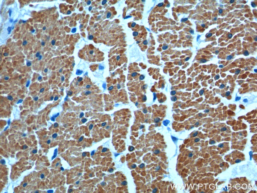 Immunohistochemistry (IHC) staining of human colon tissue using transgelin/SM22-specific Polyclonal antibody (15502-1-AP)