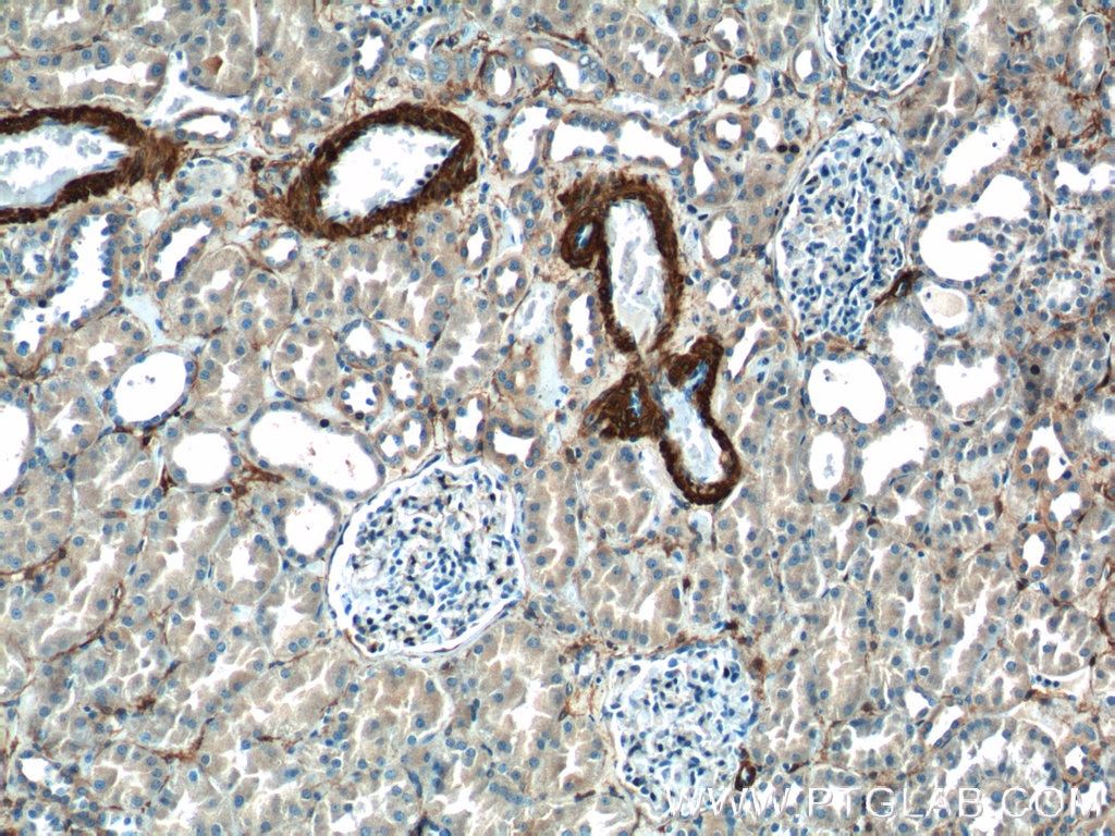 Immunohistochemistry (IHC) staining of human kidney tissue using transgelin/SM22-specific Polyclonal antibody (15502-1-AP)
