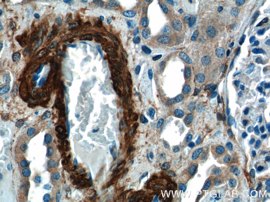 Immunohistochemistry (IHC) staining of human kidney tissue using transgelin/SM22-specific Polyclonal antibody (15502-1-AP)