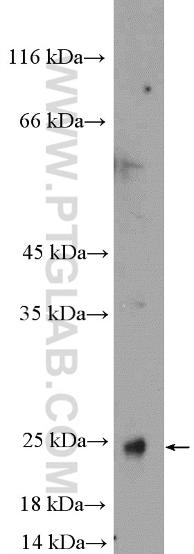 Western Blot (WB) analysis of mouse colon tissue using transgelin/SM22-specific Polyclonal antibody (15502-1-AP)