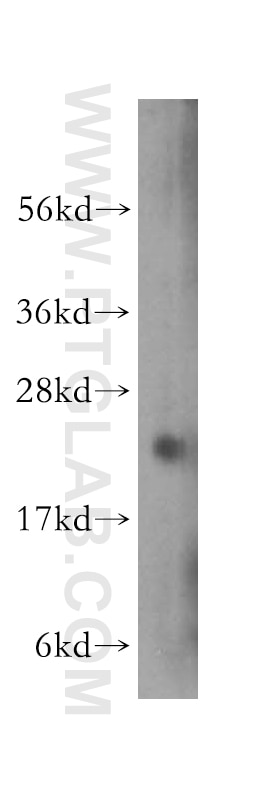 transgelin/SM22-specific