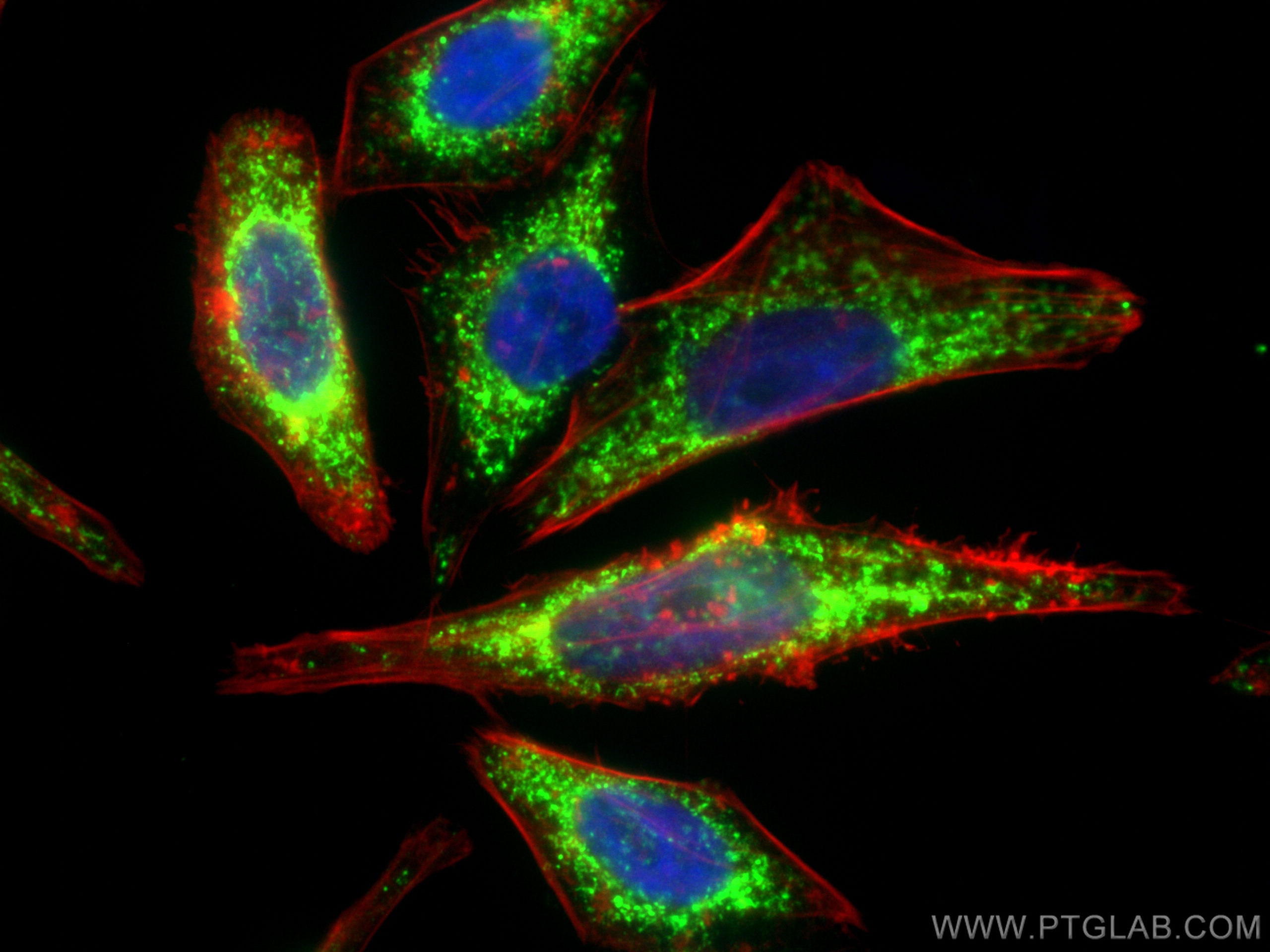 Immunofluorescence (IF) / fluorescent staining of HepG2 cells using TRAP1 Polyclonal antibody (10325-1-AP)